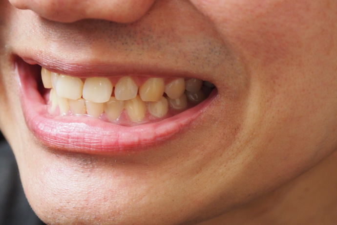 Chico mirando si tiene manchas marrones en los dientes.