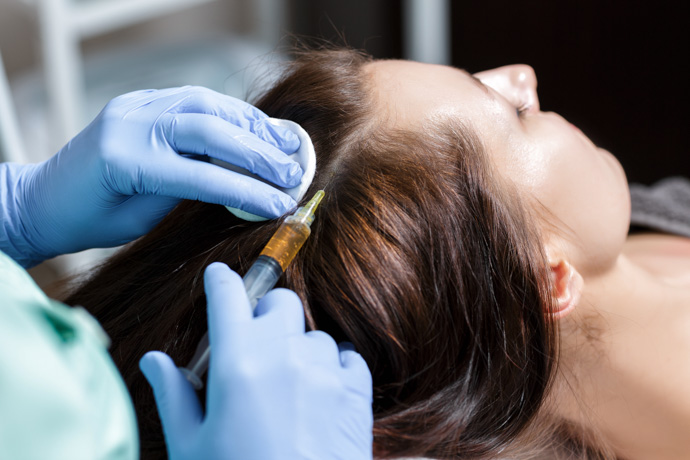Sesión de mesoterapia para el cabello
