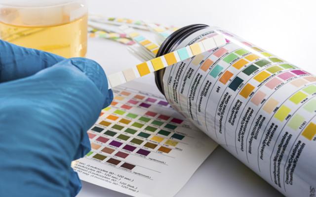 Prueba de cuerpos cetónicos en la orina sin diabetes.