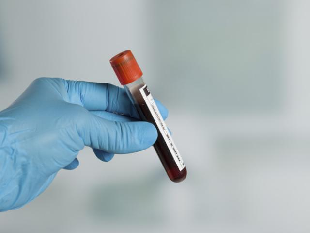 Análisis de RDW en sangre 