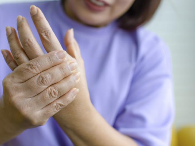 Mujer con síndrome de mano ajena