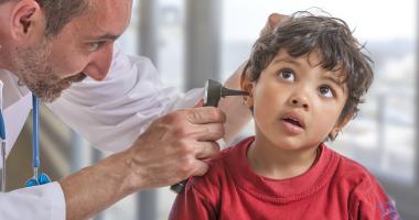 Otitis media secretora